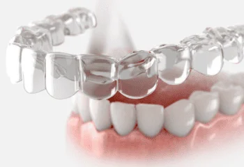 Aligners